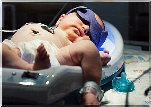 All about newborn jaundice in infants