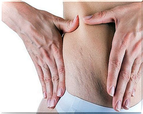 Avoid stretch marks