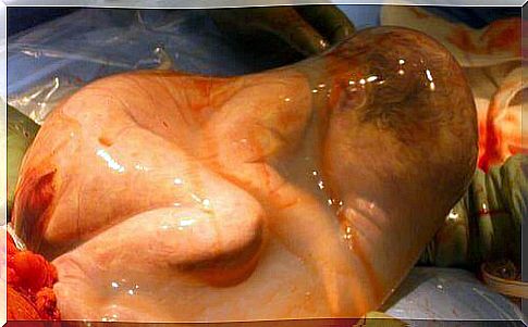 The magic of a special birth in an intact amniotic sac