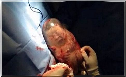 Birth with an intact amniotic sac