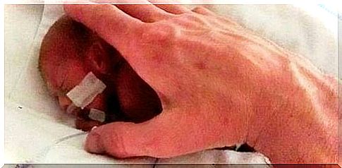 Extreme premature baby as big as a hand.